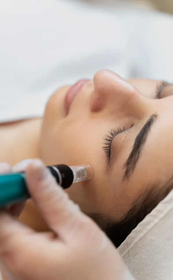 zabieg mezoterapii mikroigłowej